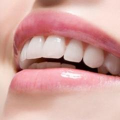 Teeth Whitening